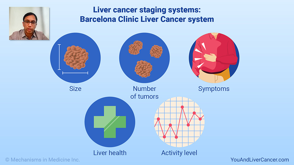 How is liver cancer staged?