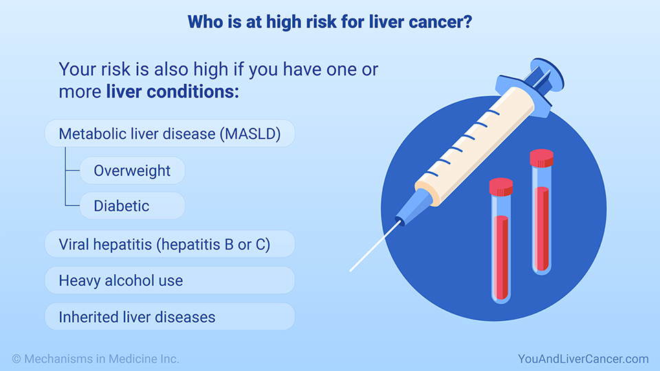 Who is at high risk for liver cancer?