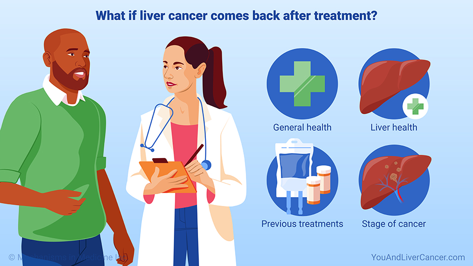 What if liver cancer comes back after treatment?