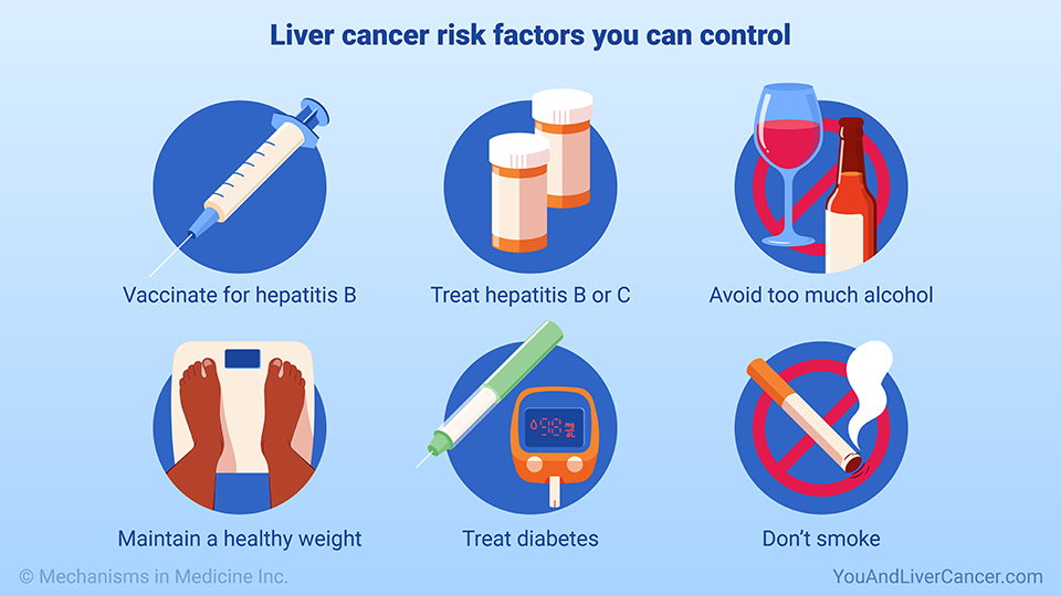 Liver cancer risk factors you can control