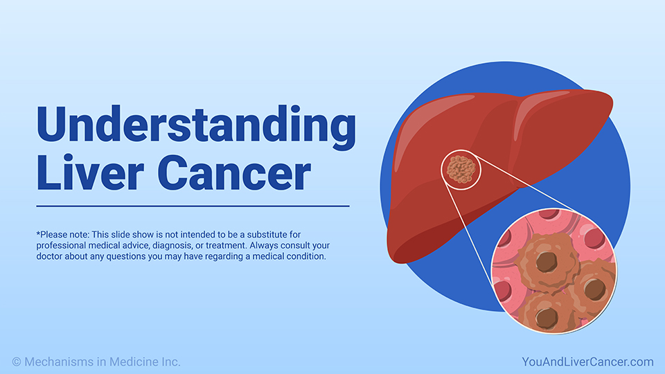 Understanding Liver Cancer