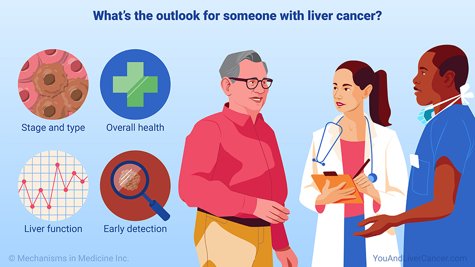 What’s the outlook for someone with liver cancer?