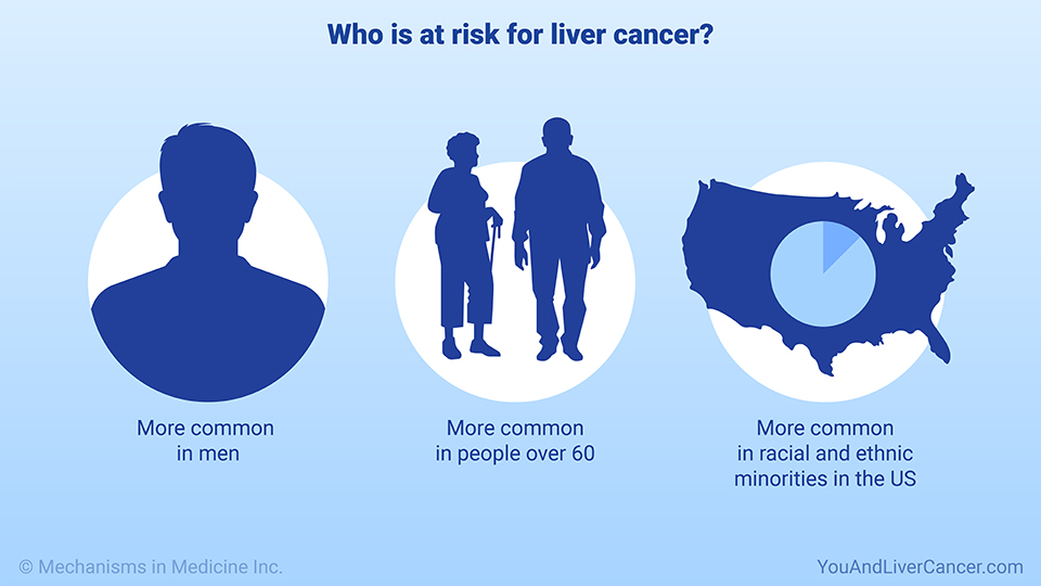 Who is at risk for liver cancer?