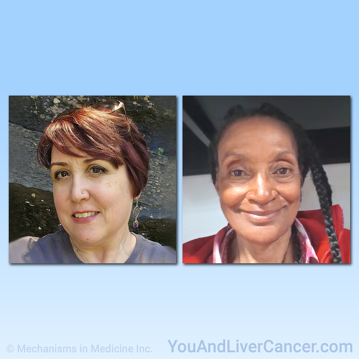 Hear from patients about their experience living with liver cancer